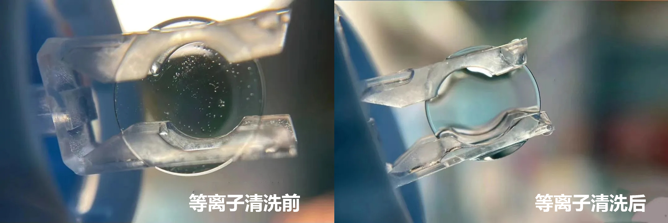 角膜塑形镜（OK镜）WWW.麻豆.COM清洗技术的应用